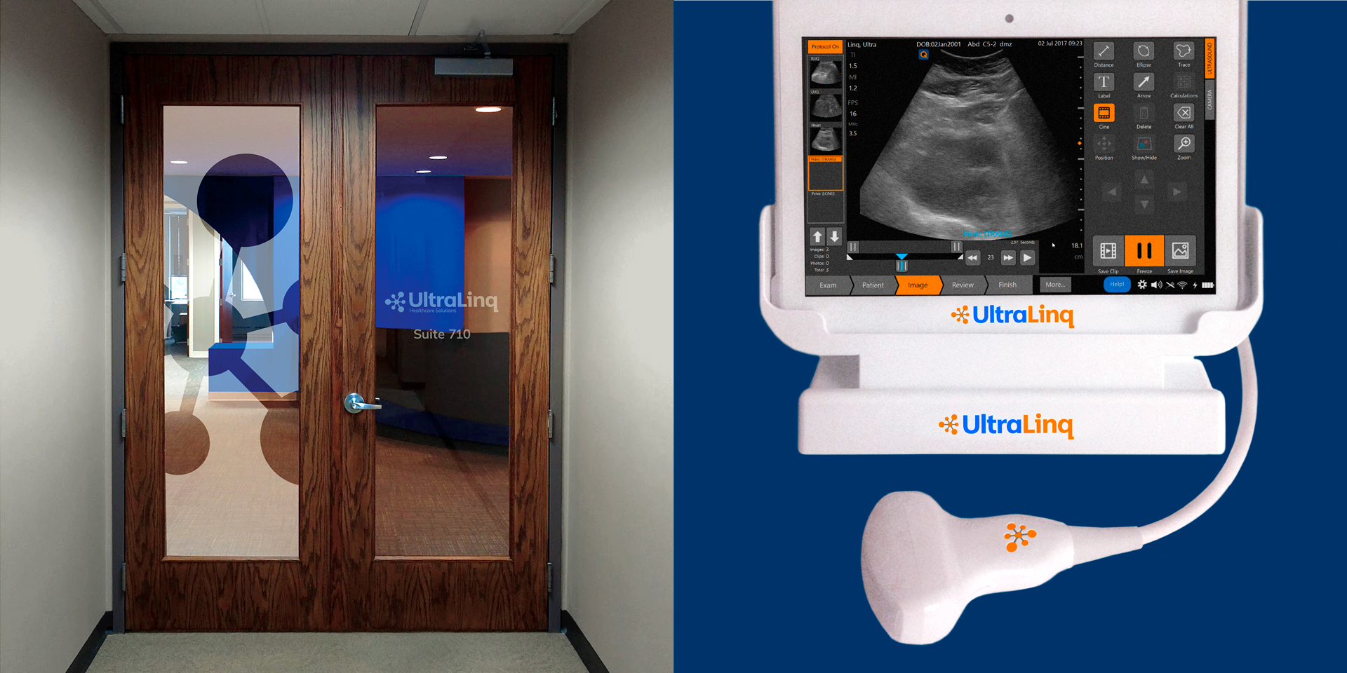 UltraLinq Door and Ultrasound Monitor